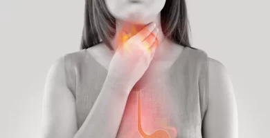 Reflujo Gastroesofágico